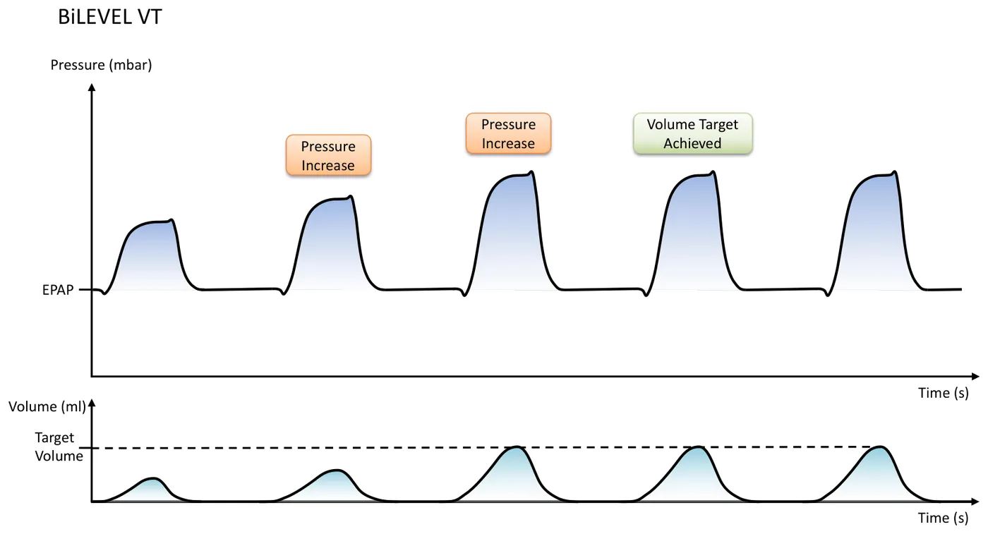 BiLEVEL VT Kurvenform