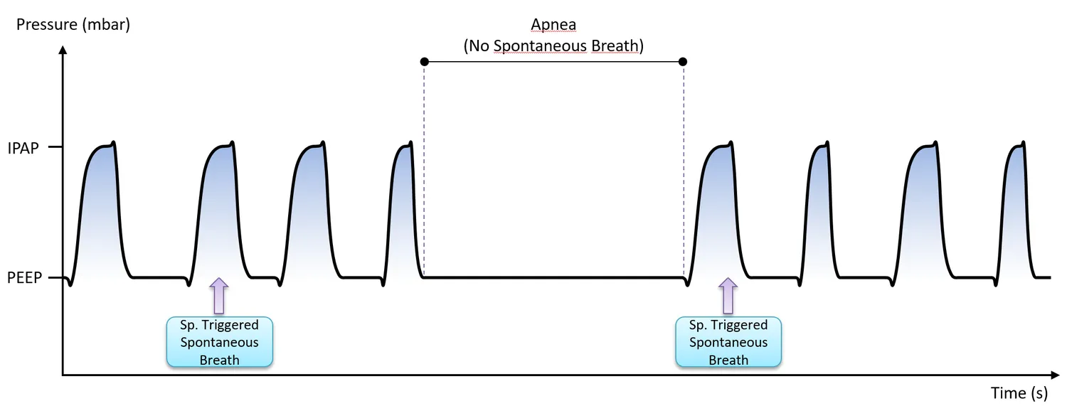 BiLEVEL waveform