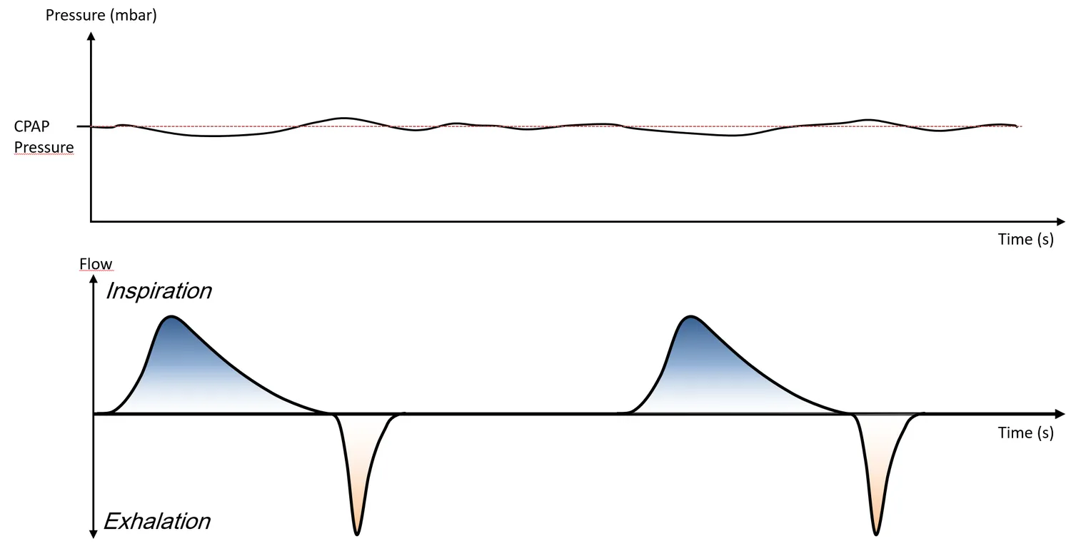 CPAP waveform