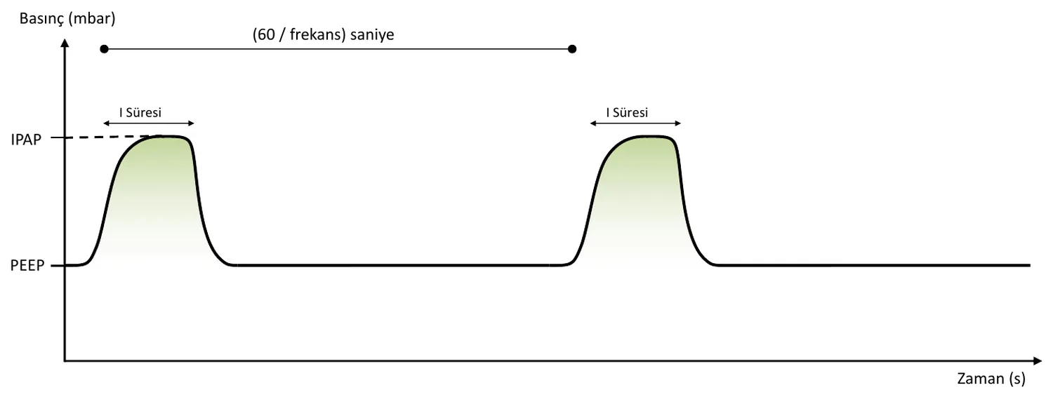 PCV waveform