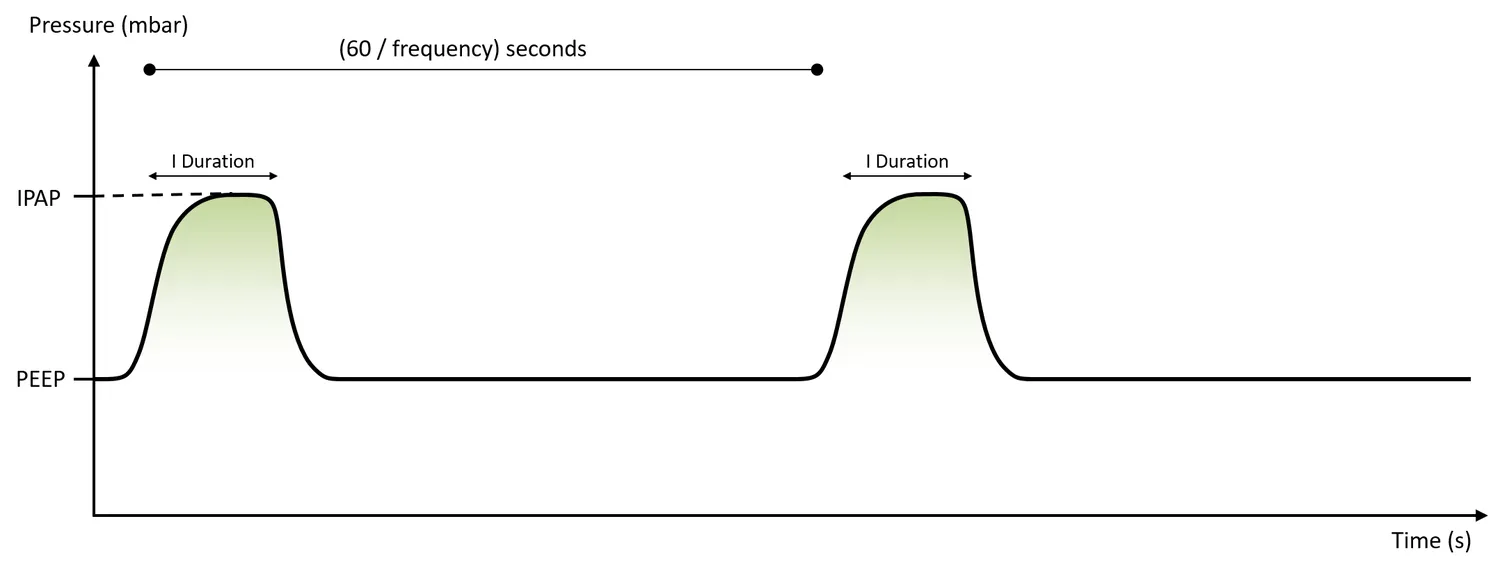 PCV waveform