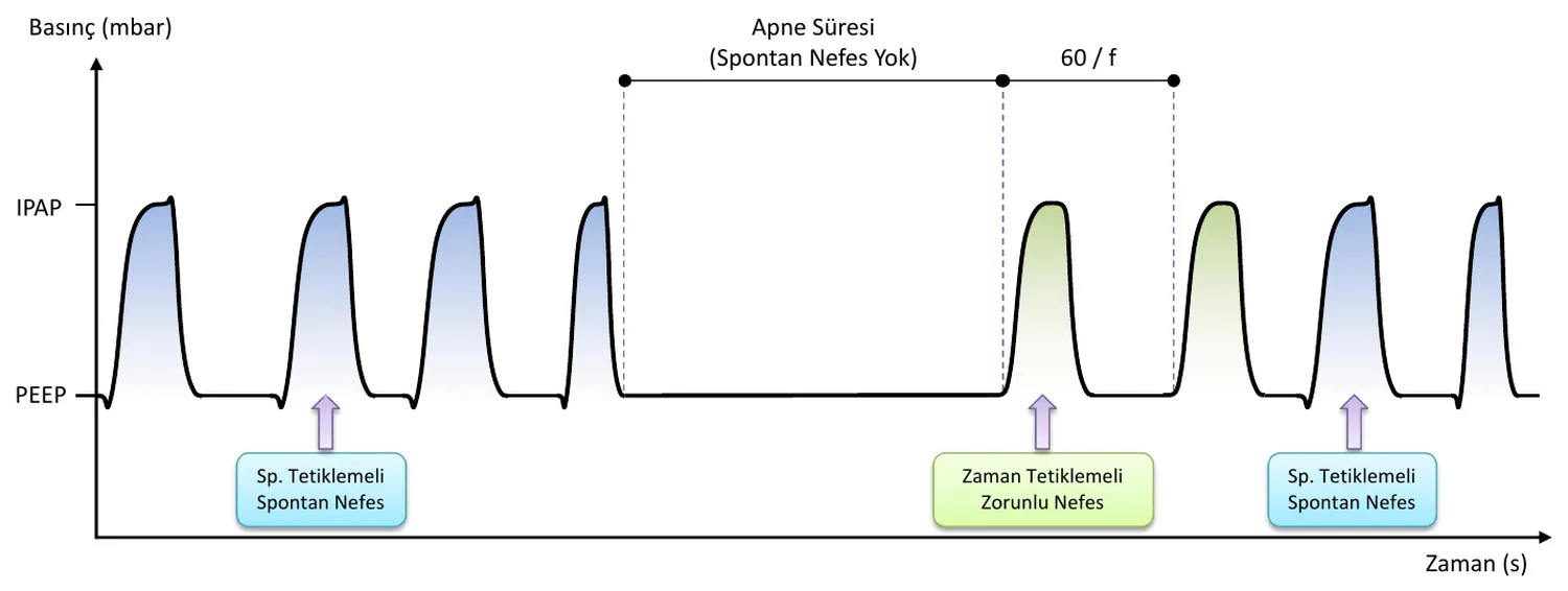 PSV waveform