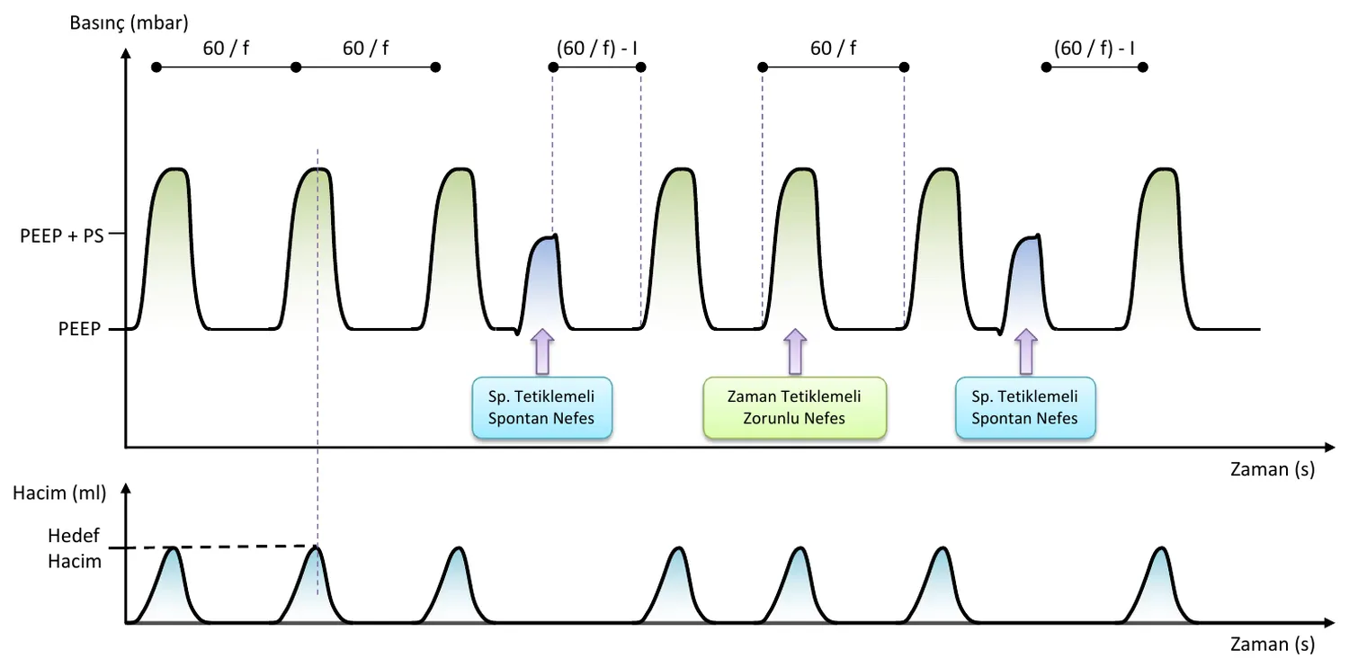 SIMV-V waveform