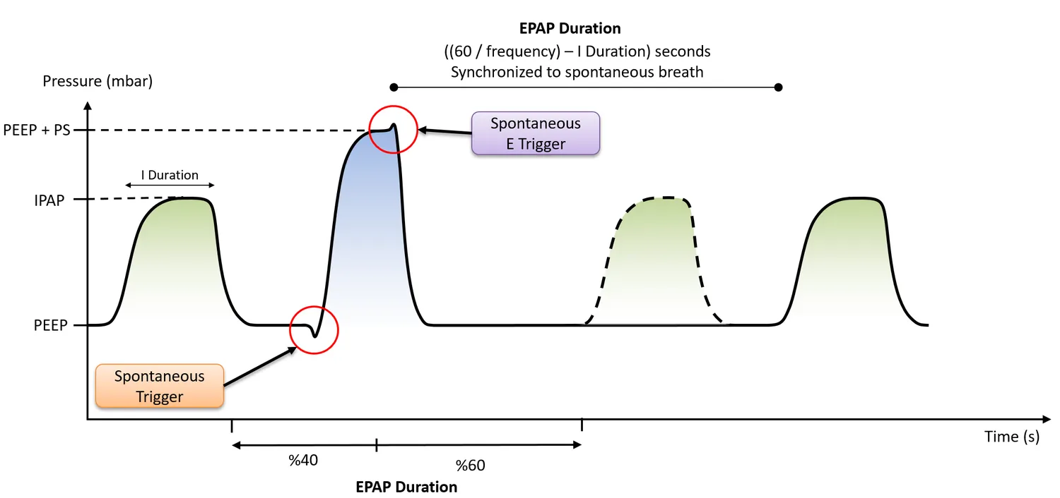 Spontanfenster — erste 40 % der EPAP-Dauer.