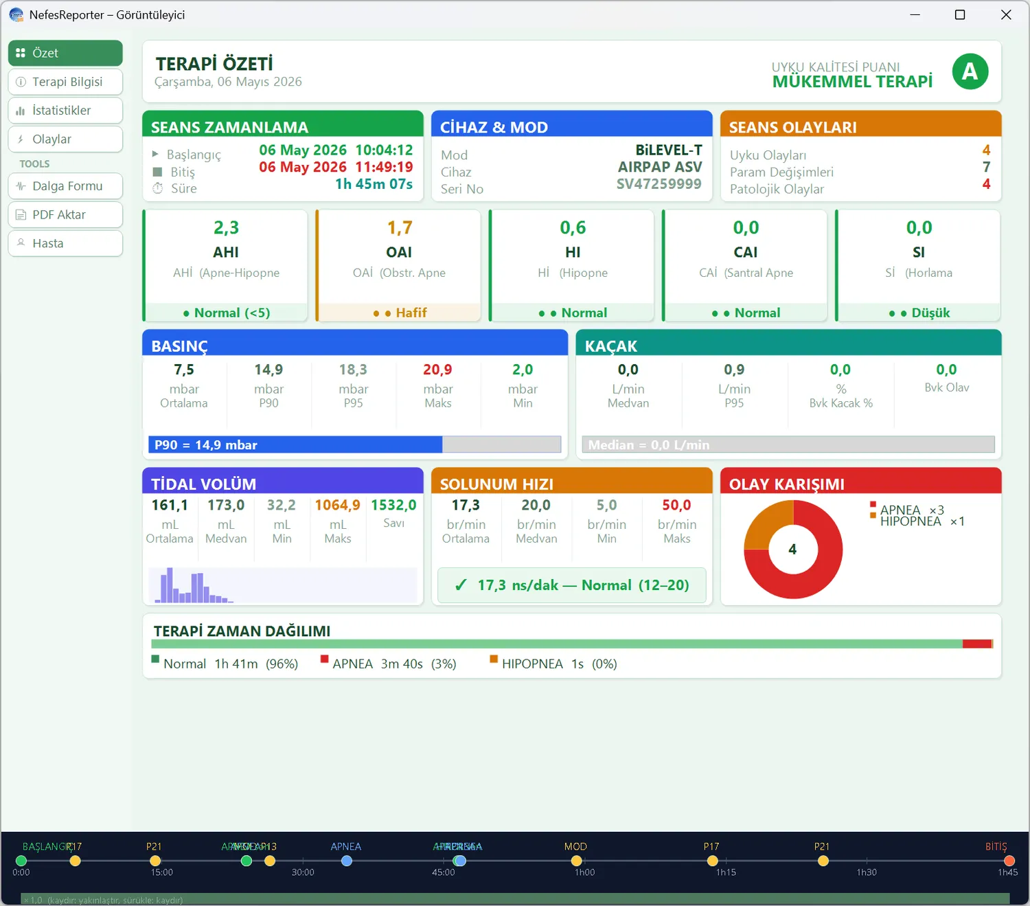 AirPAP session summary